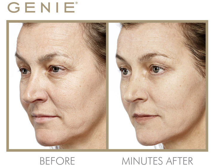 Instant Line Smoother Duo